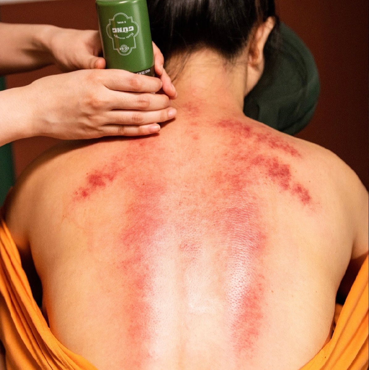 Người có cơ địa nhiễm hàn