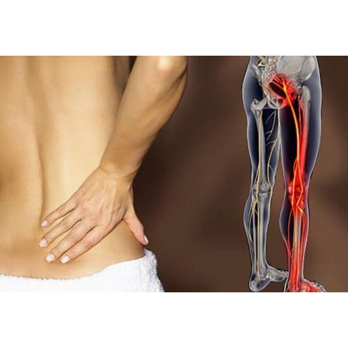 1.2. Nguyên nhân gây đau thần kinh tọa