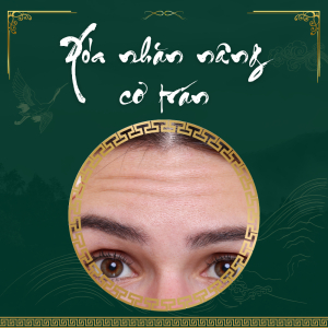 Xóa Nhăn Nâng Cơ Trán