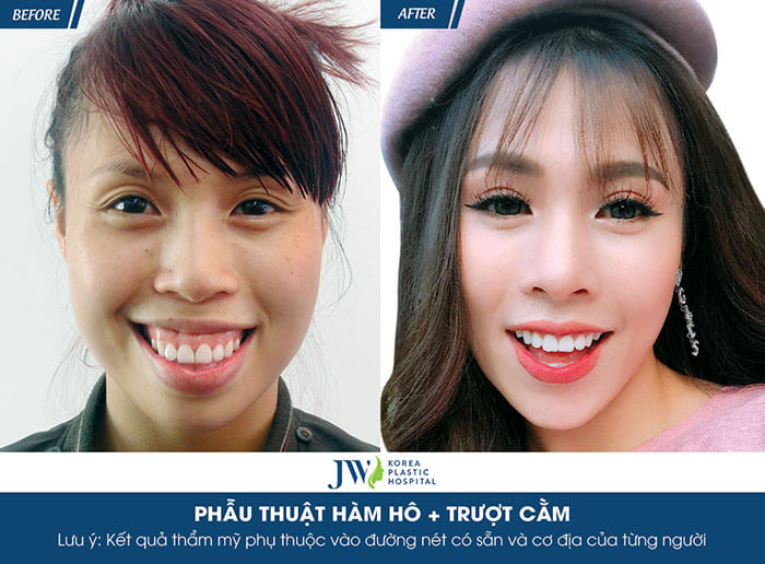 Thẩm mỹ khuôn mặt: