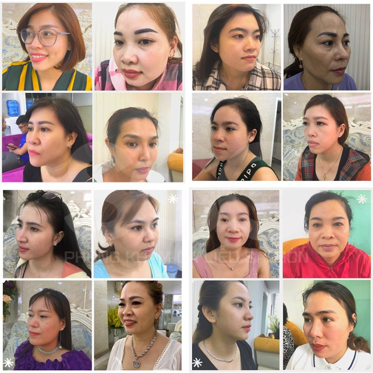 Những thành công của PKDL SG trong hơn 10 năm qua