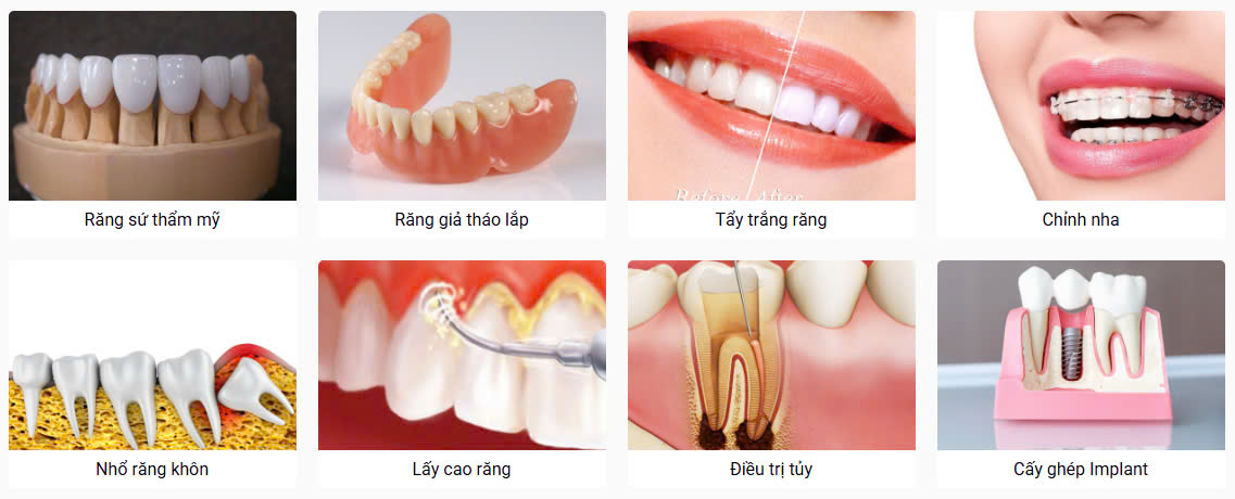 Dịch vụ nổi bật tại nha khoa Minh Nhơn