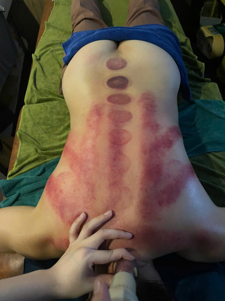 Dịch Vụ Trị Liệu Mỏi Vai Gáy Đà Nẵng