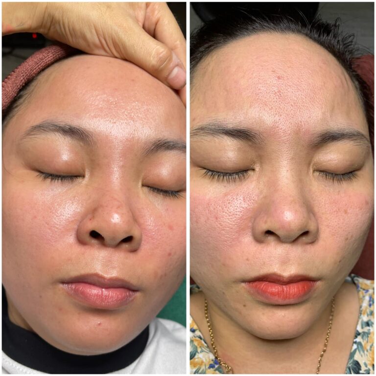 1. Dịch Vụ Chăm Sóc Da Mặt