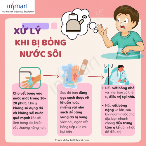 (Góc phụ huynh) [Kỹ năng an toàn cho trẻ] Dạy con cách xử trí khi bị bỏng