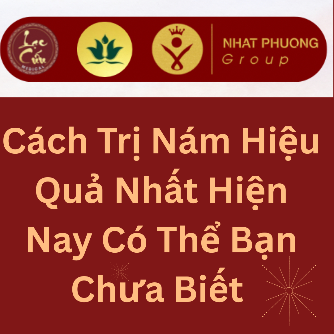 Cách Trị Nám Hiệu Quả Nhất Hiện Nay Có Thể Bạn Không Biết