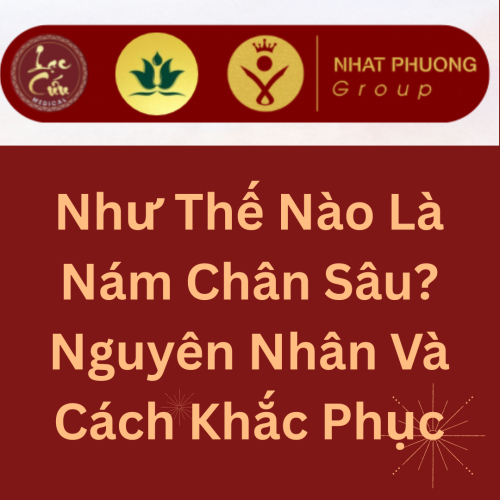 Như Thế Nào Là Nám Chân Sâu? Nguyên Nhân Và Cách Khắc Phục